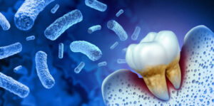 Oral bacteria from gum disease